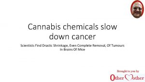 Cannabis chemicals slow down cancer Scientists Find Drastic