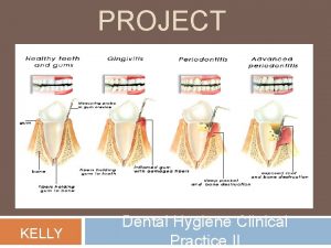 PROJECT KELLY Dental Hygiene Clinical Practice II PATIENT