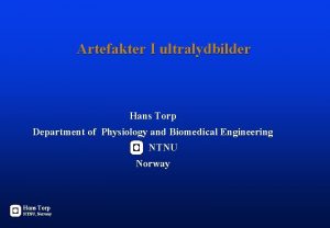 Artefakter I ultralydbilder Hans Torp Department of Physiology