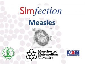 Measles Measles What is measles Infectious viral illness