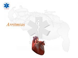 Arritmias Arritmia Significa irregularidad del ritmo cardiaco que