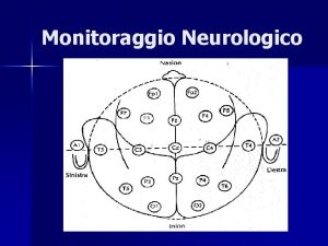 Monitoraggio Neurologico ALFA 8 13 Hz Presente nello