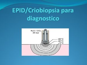 EPIDCriobiopsia para diagnostico Mecanismo de accin Produce un