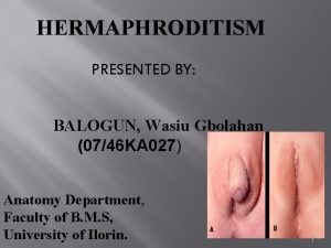 HERMAPHRODITISM PRESENTED BY BALOGUN Wasiu Gbolahan 0746 KA
