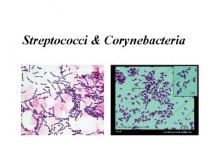 Streptococci Corynebacteria Streptococci Cocci spherical Morphology Gram positive
