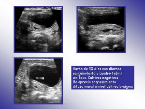 Varn de 30 das con diarrea sanguinolenta y