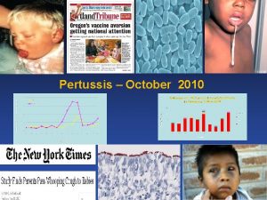 Pertussis October 2010 Pertussis Incidence Rates in the