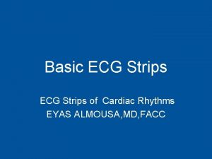 Basic ECG Strips of Cardiac Rhythms EYAS ALMOUSA