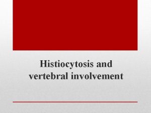 Histiocytosis and vertebral involvement q a 6 year