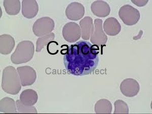 Cancer Cause Effect Toxins Smog is a type