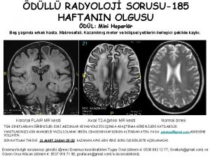 DLL RADYOLOJ SORUSU185 HAFTANIN OLGUSU DL Mini Hoparlr