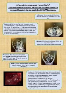 Minimally Invasive surgery at midnight A case of