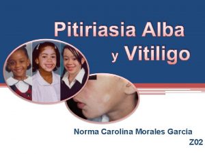 Pitiriasia Alba y Vitiligo Tosferina Norma Carolina Morales