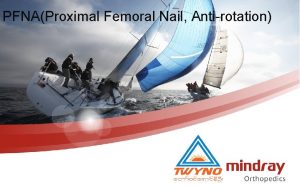 PFNAProximal Femoral Nail Antirotation Anatomy of Proximal Femur