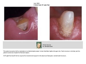 July 2003 Clinical Case DT LightPost Clinical case