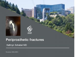 Periprosthetic fractures Kathryn Schabel MD November 2018 OAOS