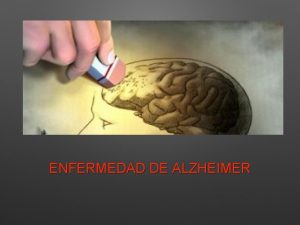 ENFERMEDAD DE ALZHEIMER ENFERMEDAD DE ALZHEIMER Edades avanzadas