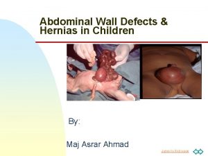 Abdominal Wall Defects Hernias in Children MM By
