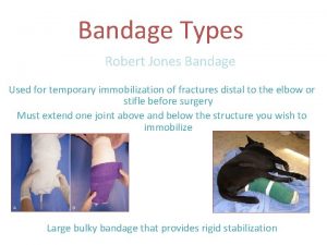 Bandage Types Robert Jones Bandage Used for temporary