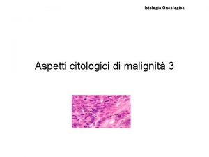 Istologia Oncologica Aspetti citologici di malignit 3 Modalit