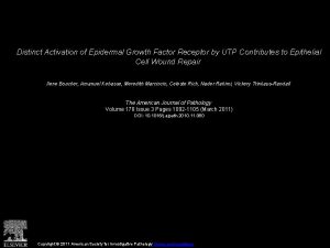 Distinct Activation of Epidermal Growth Factor Receptor by