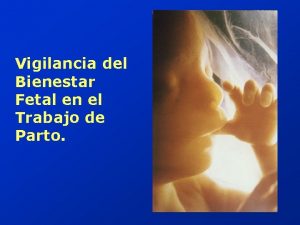 Vigilancia del Bienestar Fetal en el Trabajo de