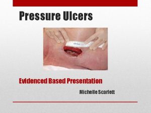 Pressure Ulcers Evidenced Based Presentation Michelle Scarlett Purpose