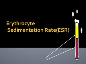 Erythrocyte Sedimentation RateESR Objectives ESR is the rate