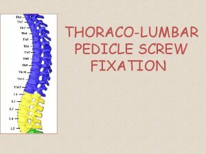 THORACOLUMBAR PEDICLE SCREW FIXATION Contents Introduction History Surgical