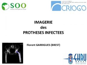 IMAGERIE des PROTHESES INFECTEES Florent GARRIGUES BREST 1XX