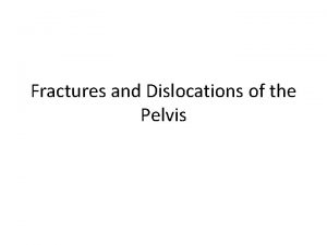 Fractures and Dislocations of the Pelvis Sacral Fractures