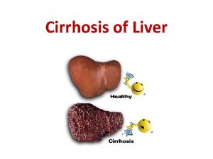 Cirrhosis of Liver Introduction The term cirrhosis was