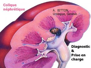 Colique nphrtique A BITTON Urologue Genve Diagnostic Prise