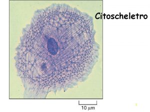 Citoscheletro 1 Citoscheletro 2 C CITOSCHELETRO movimento e