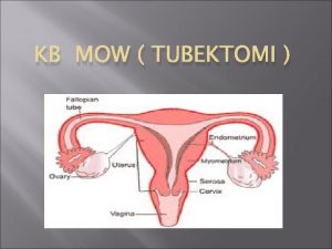 KB MOW TUBEKTOMI PENGERTIAN MOW adalah prosedur bedah