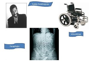 Teddy Pendergrass Wheelchair Paraplegia Teddy Pendergrass was born