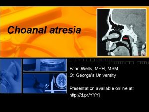 Choanal atresia Brian Wells MPH MSM St Georges