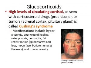 Glucocorticoids High levels of circulating cortisol as seen