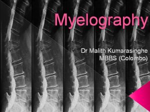 Myelography Dr Malith Kumarasinghe MBBS Colombo What is