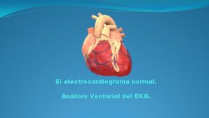 El electrocardiograma normal Anlisis Vectorial del EKG Si