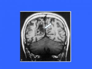 Anatomical Orientation Clinical Orientation Atlas Fig 6 24