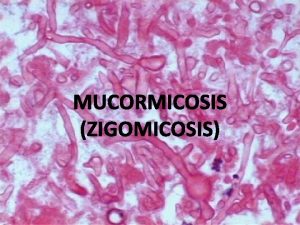 MUCORMICOSIS ZIGOMICOSIS Rhizopus Mucor Cunninghamella Apophysomyces Absidia Saksenae