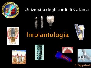 Universit degli studi di Catania Implantologia S Pappalardo