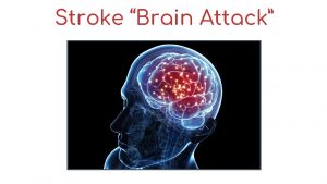 Stroke Brain Attack BRAIN ACMC ATTACK Stroke Death