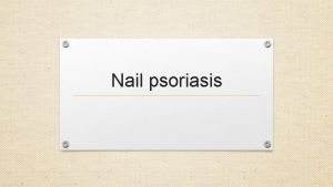 Nail psoriasis psoriasis of the nails develops is