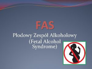 FAS Podowy Zesp Alkoholowy Fetal Alcohol Syndrome FAS
