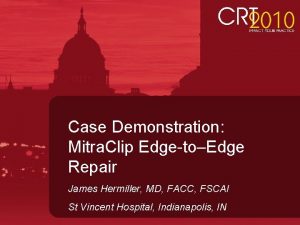 Case Demonstration Mitra Clip EdgetoEdge Repair James Hermiller