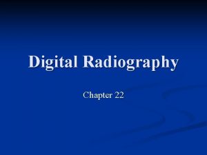 Digital Radiography Chapter 22 History of Digital Radiography