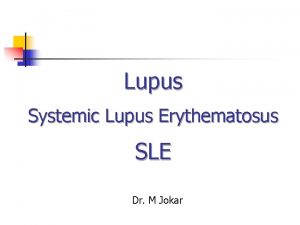 Lupus Systemic Lupus Erythematosus SLE Dr M Jokar