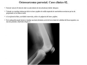Osteosarcoma parostal Caso clnico 02 Paciente varn de